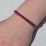 Ruby Bling Bijou bracelet